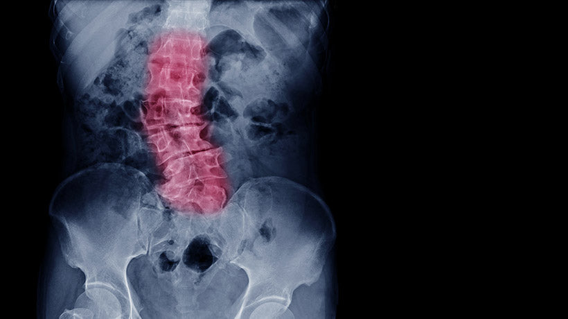 Can a Slim Wallet Really Help Your Back?